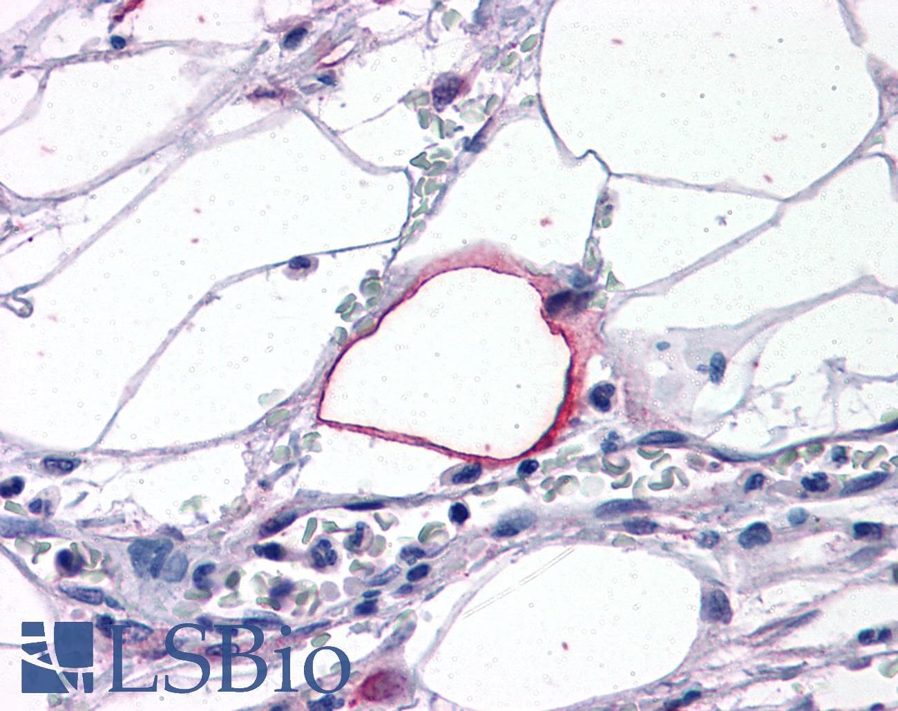 IHC-plus™ TRIM7 Antibody (aa209-221)