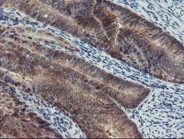 PGM3 Antibody (clone OTI1B8)