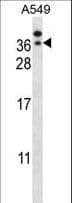 Polyclonal Rabbit anti-Human GTF2E2 Antibody (aa240-269, WB)