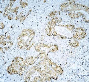 Polyclonal Rabbit anti-Human DARS2 Antibody (IHC, WB)