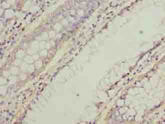 NMUR1 Antibody