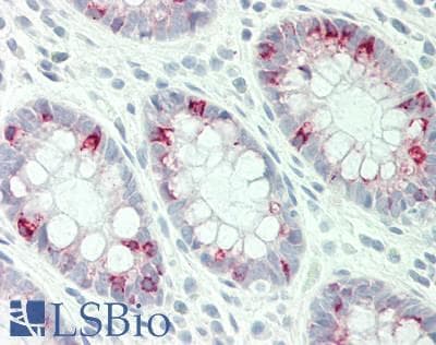 Polyclonal Rabbit anti-Human STYK1 Antibody (aa295-344, IHC, WB)
