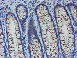 Monoclonal Mouse anti-Human SENP2 Antibody (clone OTI6F1, IHC, IF, WB)