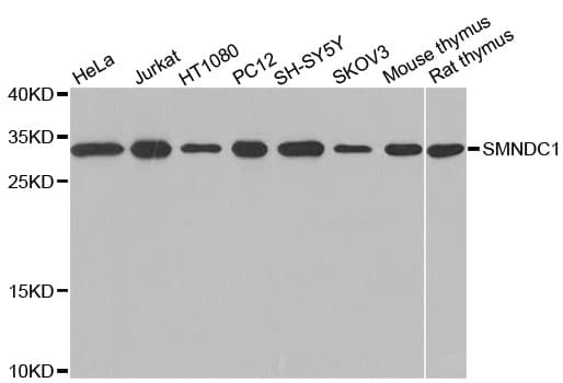 SMNDC1 Antibody