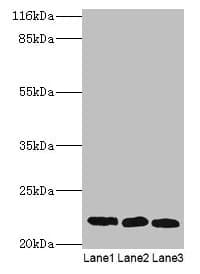 SSSCA1 / p27 Antibody