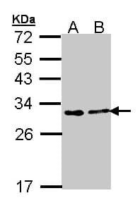 IHC-plus™ Polyclonal Rabbit anti-Human FKBP25 / FKBP3 Antibody (IHC, WB)