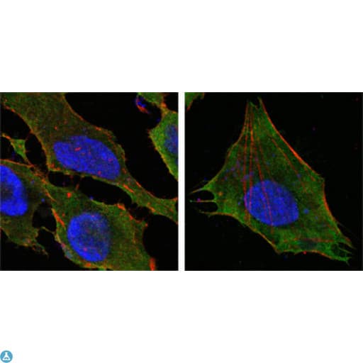 S100A10 Antibody