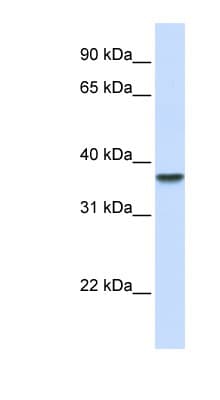 DDAH1 Antibody (aa108-157)