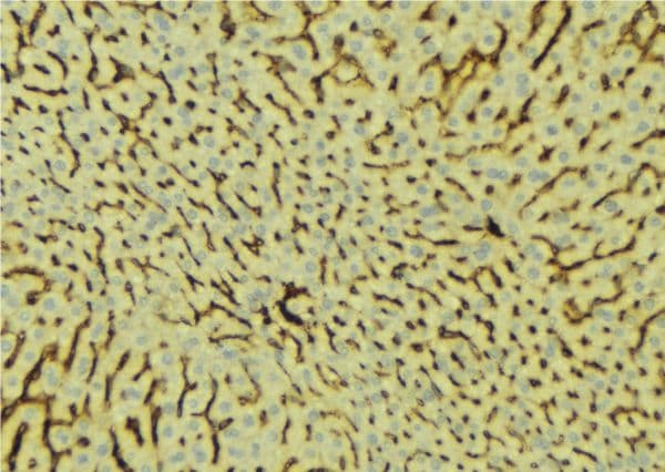 Polyclonal Rabbit anti-Human PROC / Protein C Antibody (IHC, IF, WB)