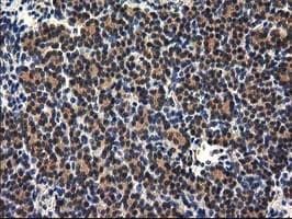 RASSF1 / RASSF1A Antibody (clone OTI2B11)