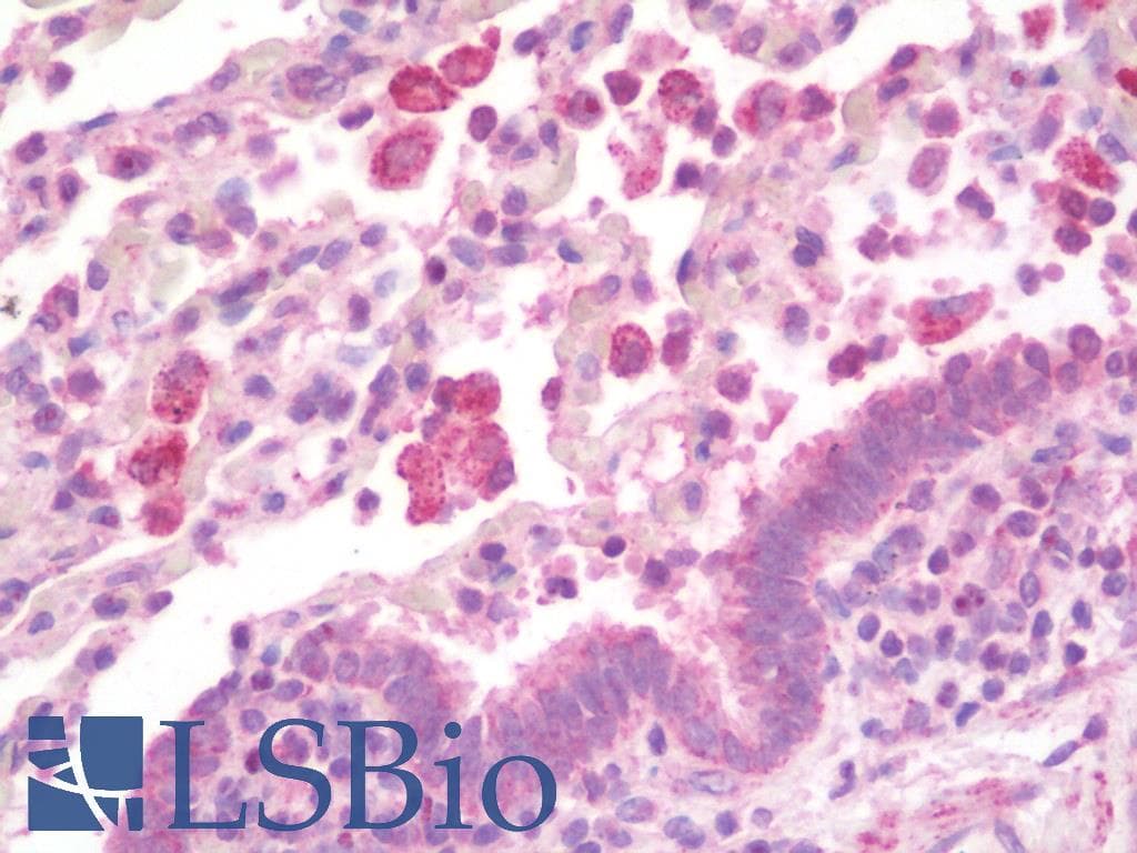 IHC-plus™ Polyclonal Rabbit anti-Human TSC22D3 / GILZ Antibody (IHC, IF, WB)