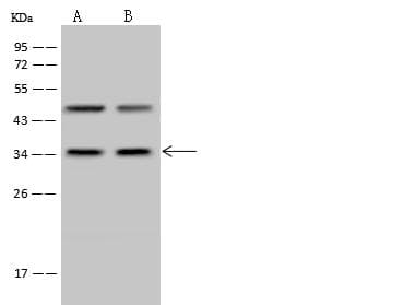 Polyclonal Rabbit anti-Human PPP4C Antibody (Preservative Free, WB)