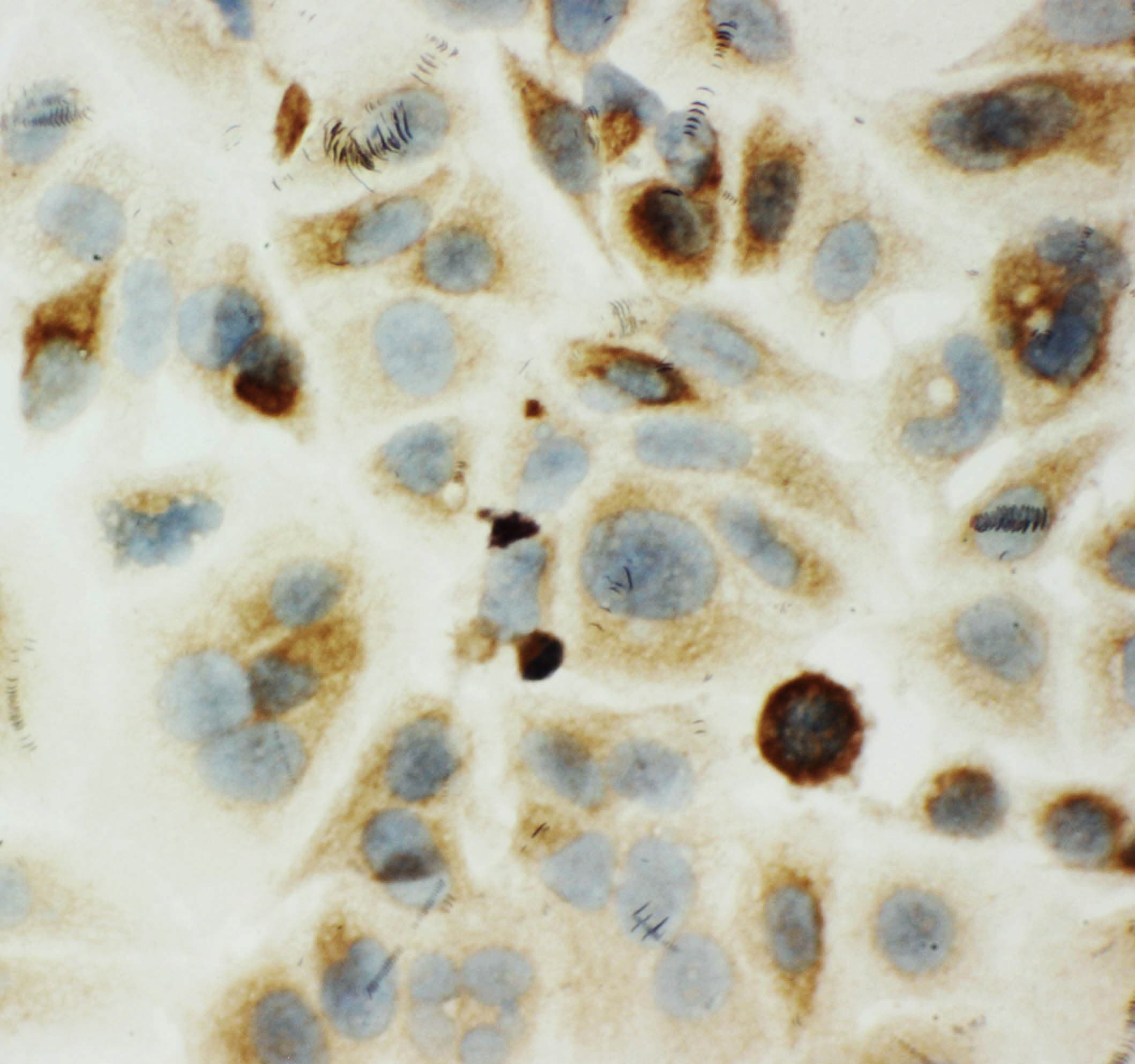 HYAL1 Antibody (aa32-47)
