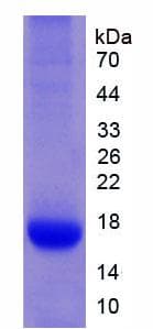 Human IL32 Protein (Recombinant His, N-Terminal)