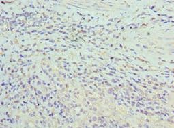 Polyclonal Rabbit anti-Human ASF1A Antibody (aa1-204, IHC, WB)