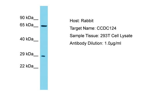Polyclonal Rabbit anti-Human CCDC124 Antibody (aa46-95, WB)