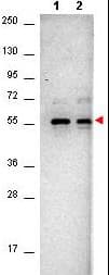AKT1 Antibody (Internal, clone 14E5.16C8.25F6)