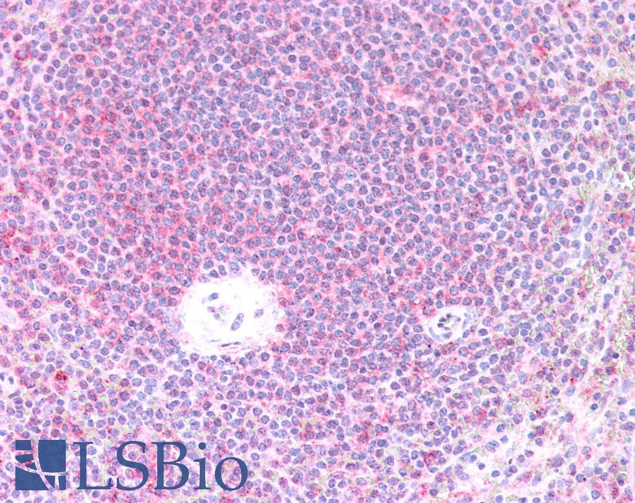 IHC-plus™ LIMS1 / PINCH Antibody