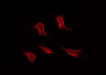 TP53 / p53 Antibody (phospho-Ser366)