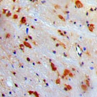 Polyclonal Rabbit anti-Human VCP Antibody (Internal, IHC, WB)
