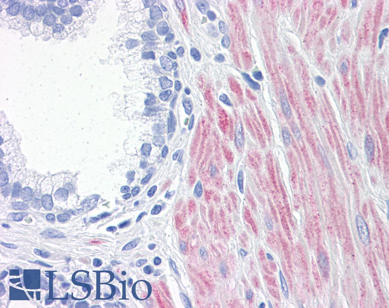 IHC-plus™ ALOX15 / 15-Lipoxygenase Antibody (clone 3D8)
