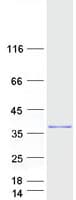 Human HSF2BP Protein (Recombinant Myc-DDK (Flag))
