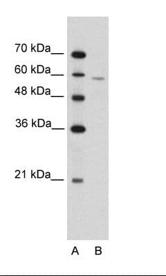IRX4 Antibody (aa66-115)