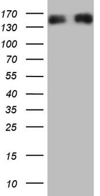 NEFM / NF-M Antibody (aa413-773, clone OTI5H4)