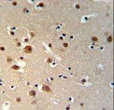 TTBK1 Antibody (aa230-258)