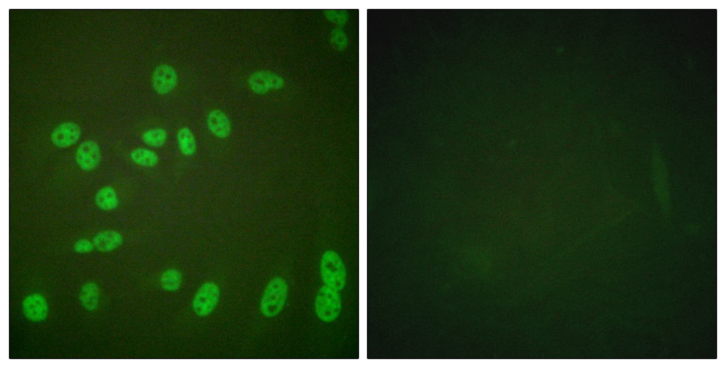 POLR2A / RNA polymerase II Antibody (phospho-Ser1619)