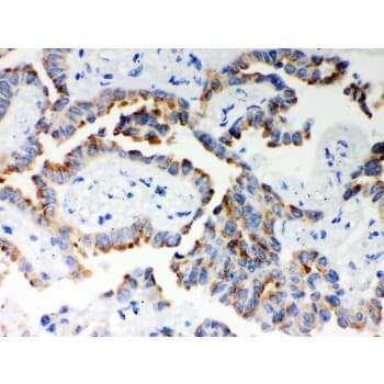Polyclonal Rabbit anti-Human ITPR3 Antibody (aa70-95, IHC, WB)