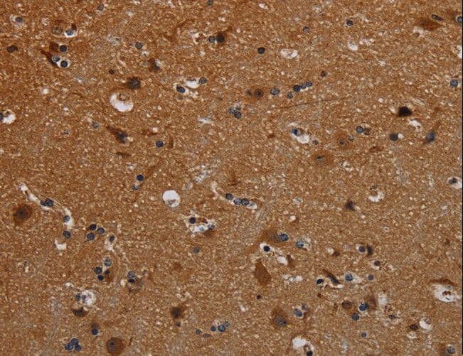 PCDHB15 Antibody