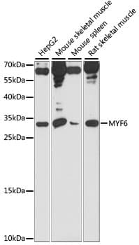 Polyclonal Rabbit anti-Human MYF6 / MRF4 Antibody (WB)