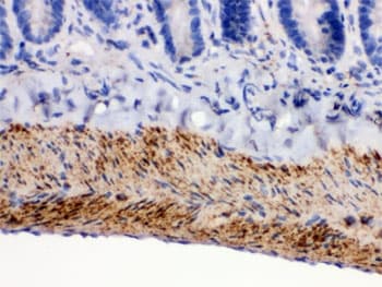 MAOB / Monoamine Oxidase B Antibody