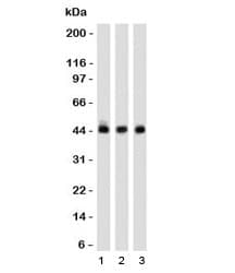 NAPSA / NAPA / Napsin A Antibody (clone NPSNA-1)