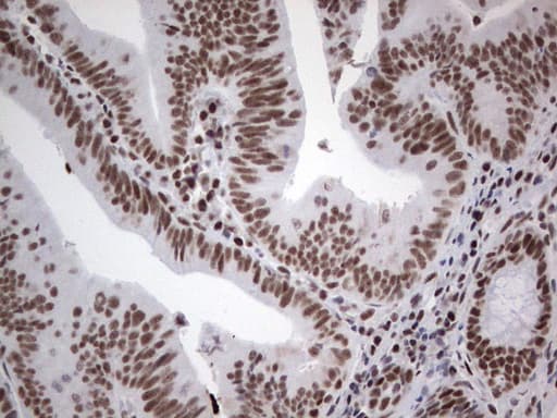 HDAC9 Antibody (aa181-460, clone OTI7G2, Carrier-free)
