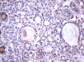 CD30 Antibody (clone OTI18D3)