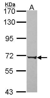 IHC-plus™ Polyclonal Rabbit anti-Human PABPC3 Antibody (aa107-323, IHC, WB)