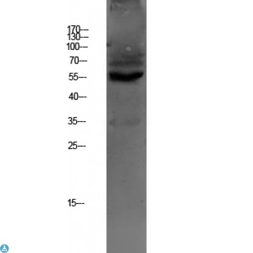 Polyclonal Rabbit anti-Human SLC22A6 / OAT1 Antibody (WB)