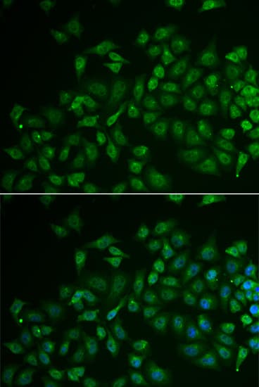 MPP2 Antibody