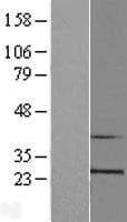 RPL10 / Ribosomal Protein L10 (Over-Expression Lysate Myc-DDK (Flag))