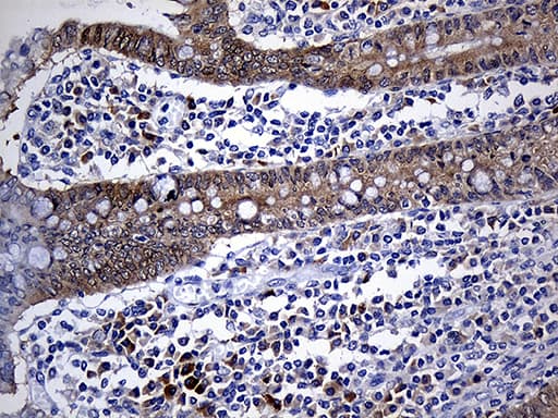 NAT1 / AAC1 Antibody (clone OTI6D7)