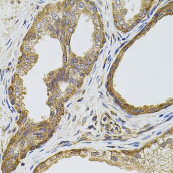 Polyclonal Rabbit anti-Human EGFR Antibody (IHC, IF, WB)