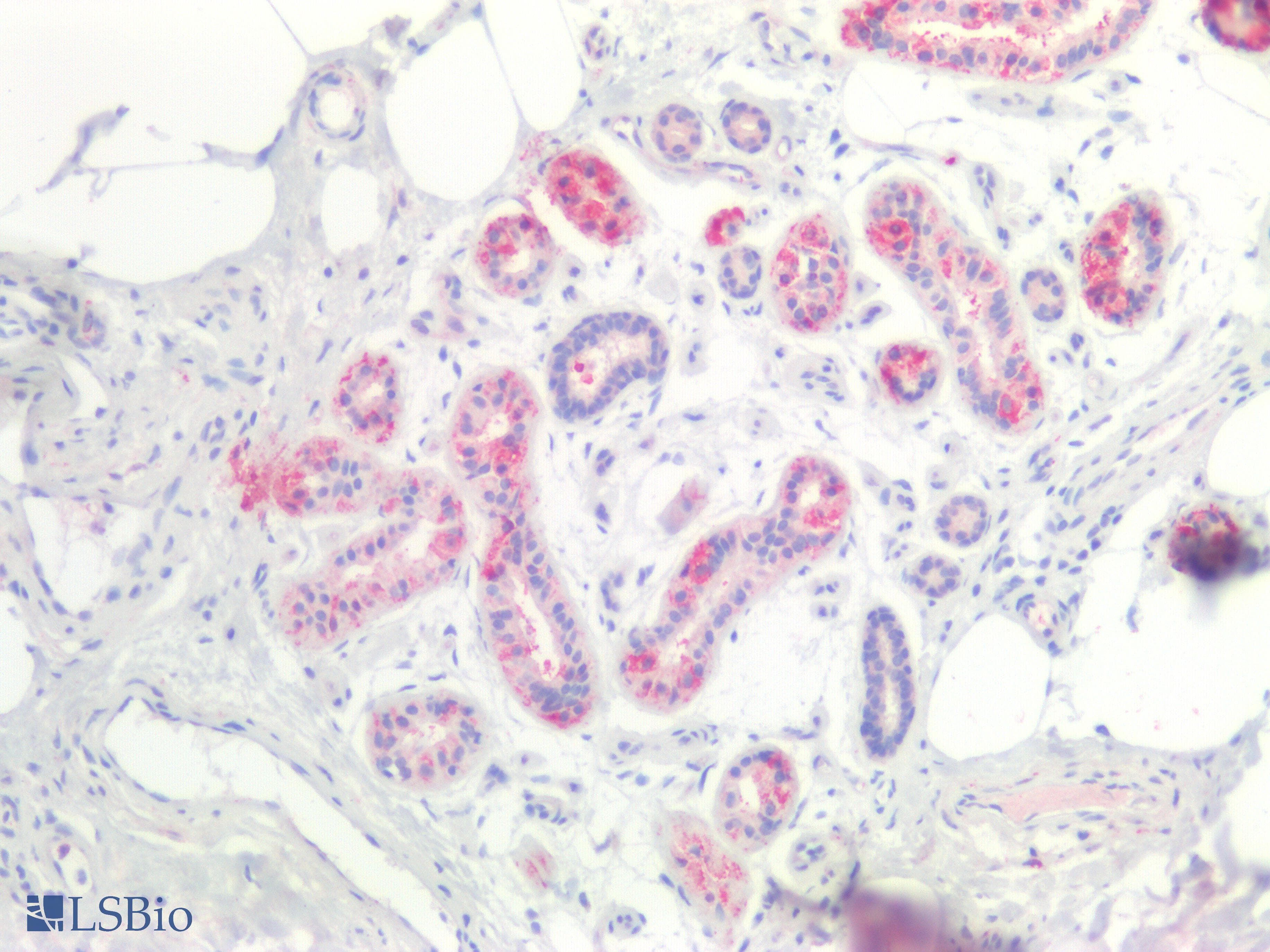 PathPlus™ Polyclonal Rabbit anti-Mouse CTNNBIP1 / ICAT Antibody (aa1-81, IHC, WB)