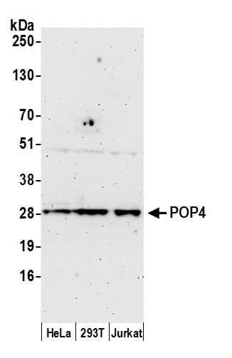 POP4 Antibody (aa170-220)