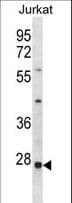 Polyclonal Rabbit anti-Human TIP30 / HTATIP2 Antibody (aa45-74, IHC, WB)