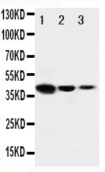 ERBB4 / HER4 Antibody (aa35-51)