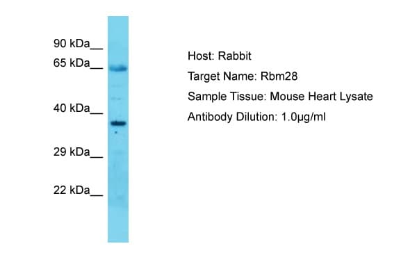 Polyclonal Rabbit anti-Mouse RBM28 Antibody (C-Terminus, WB)