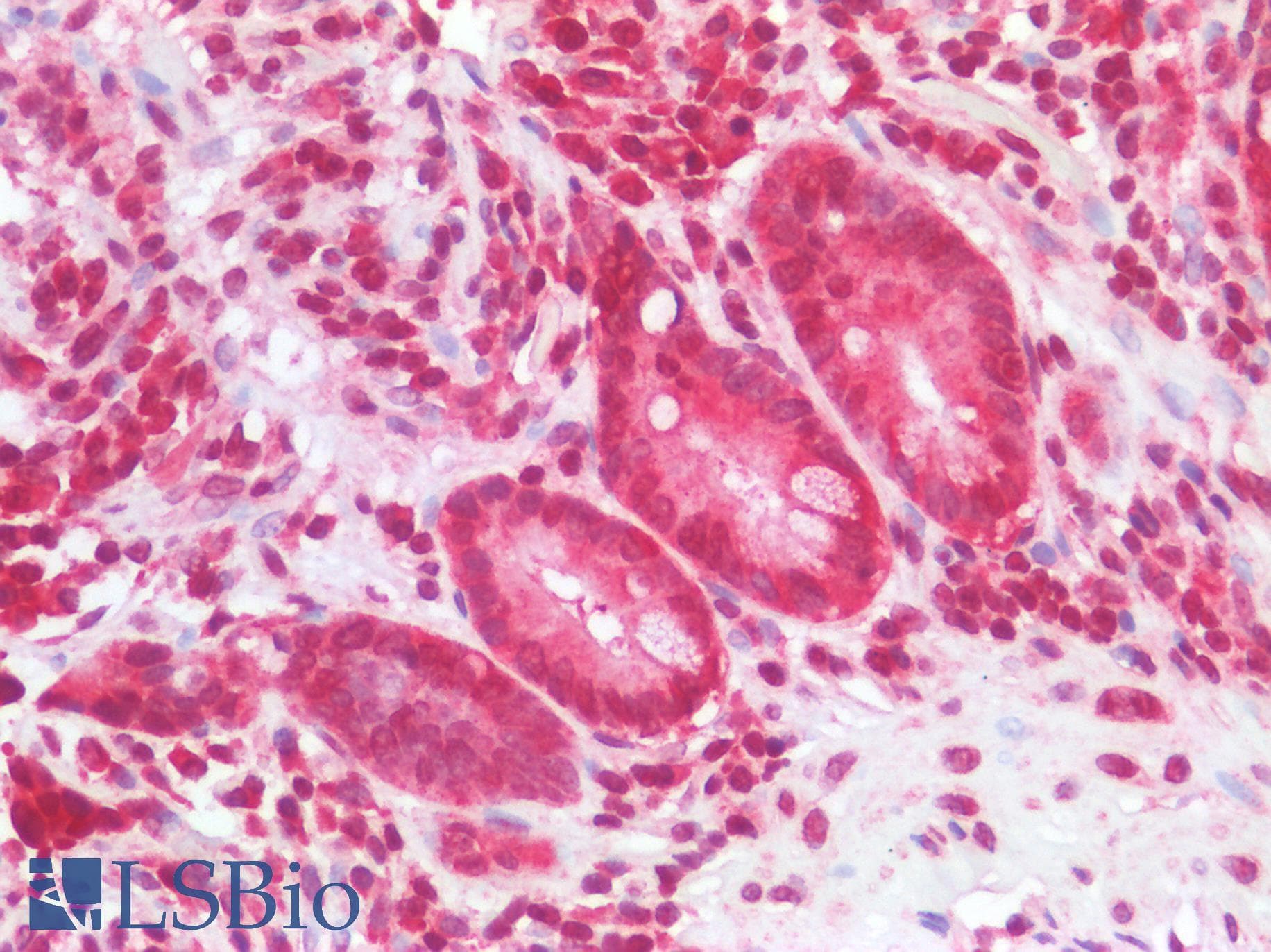 PathPlus™ NALP3 / NLRP3 Antibody (aa158-207)