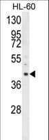 Polyclonal Rabbit anti-Human LRG1 / LRG Antibody (aa86-114, IHC, WB)